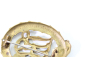 Preview: Deutsches Turn- und Sportabzeichen 1919-1934 DRA in Bronze